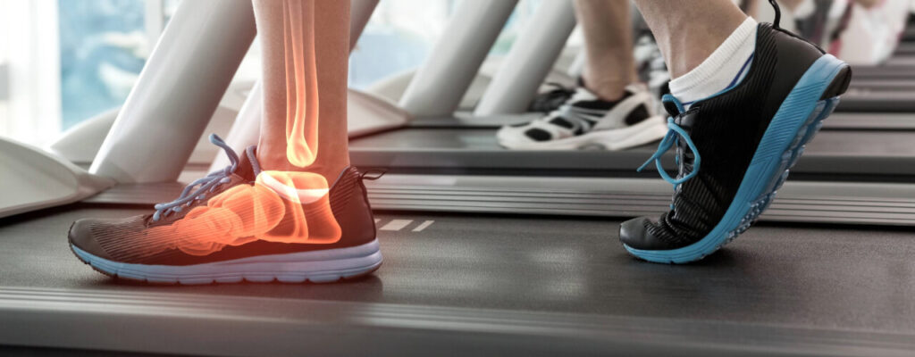 Accelerating Ankle Surgery Recovery