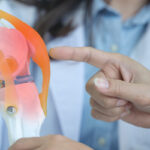 Finding Relief After Total Hip or Knee Replacements